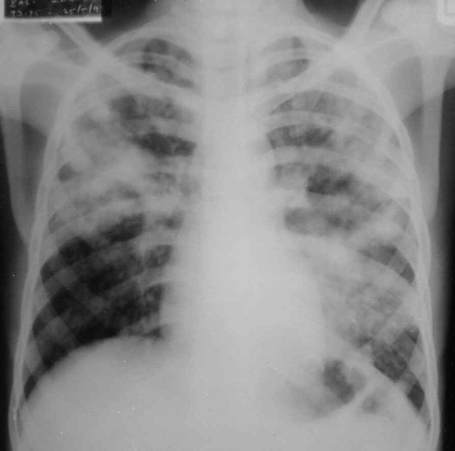 Critical Care