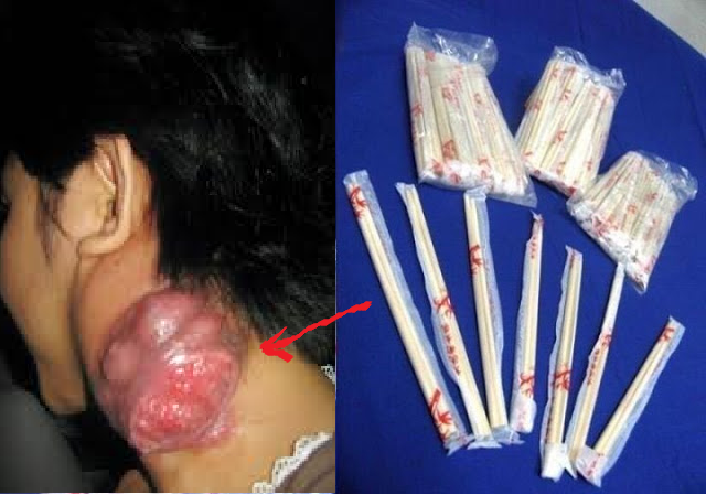 Anda Suka Makan Mie? Hati-Hati Menggunakan Alat Ini! Anda Suka Makan Mie? Hati-Hati Menggunakan Alat Ini!