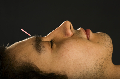 Weight Reduction With Acupuncture|can Acupuncture Enable You To Shed Weight'