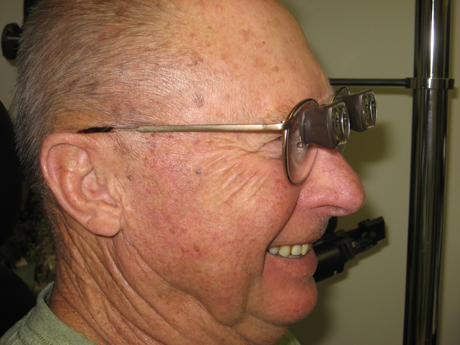 Low Vision Eyeglasses Low Vision Treatment for
