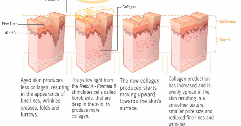 Learn How To Live Well!: Retinoid Treatment and Your Skin Learn How To Live Well!: Retinoid Treatment and Your Skin