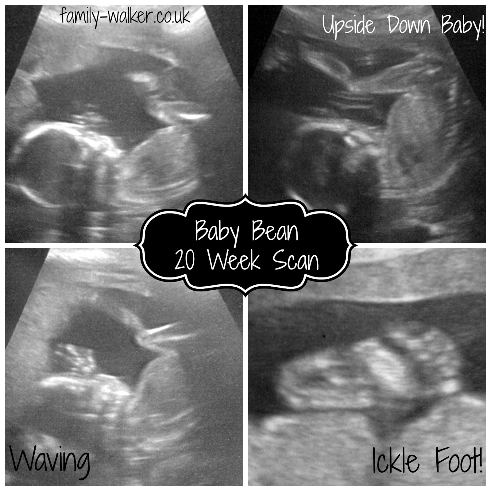 "Baby Bean" - 20 week scan pictures
