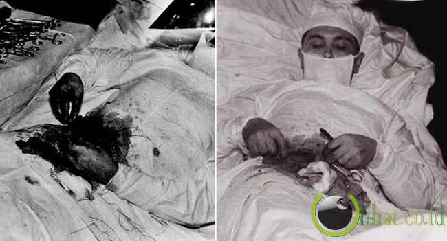 Dr Leonid Rogozov,Born 1937....Operasi Appendictomy Dr Leonid Rogozov,Born 1937....Operasi Appendictomy