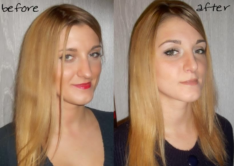 Zuckerwattenerdbeere 10 e Nach Der Nasen Op