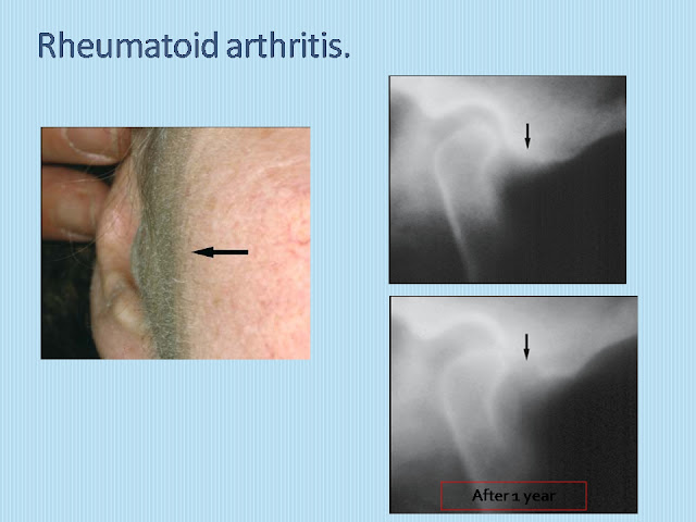 TMJ+19.jpg