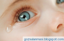 Goz Sulanmasi Nedenleri Ve Tedavi Yontemleri