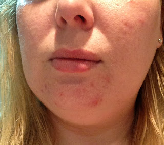impressions liquid alpha gold 10th skin march