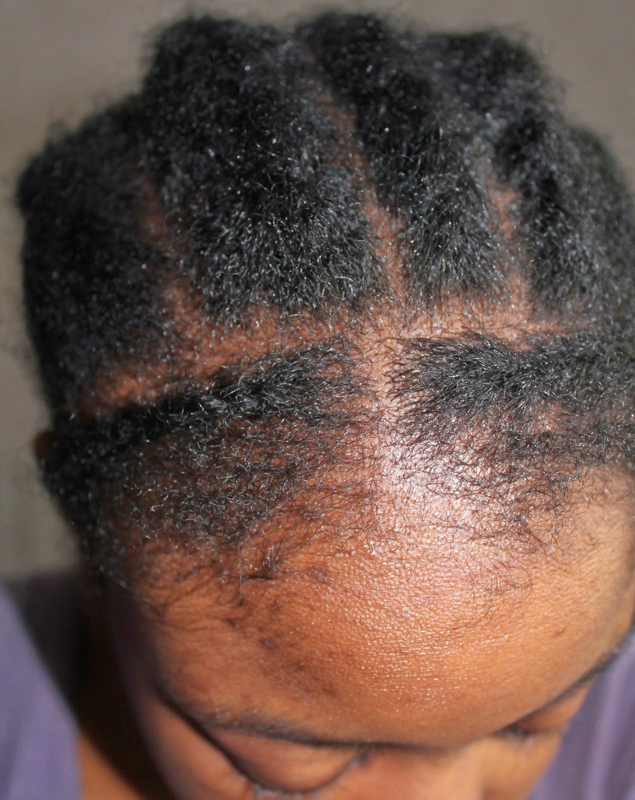 It's a wig! Braid pattern Nappy & Kinky The road to "good hair"