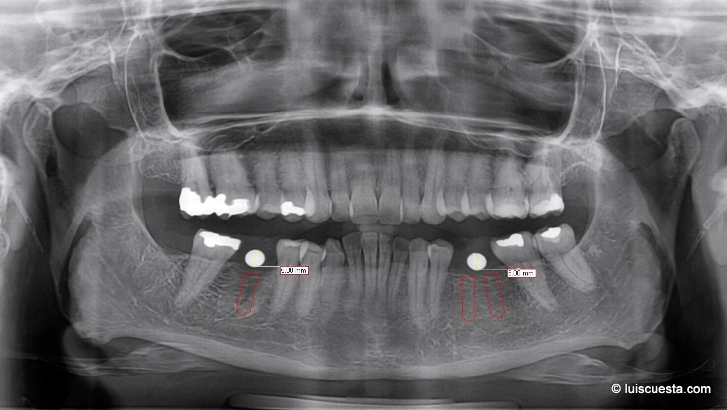club rencontre amiez