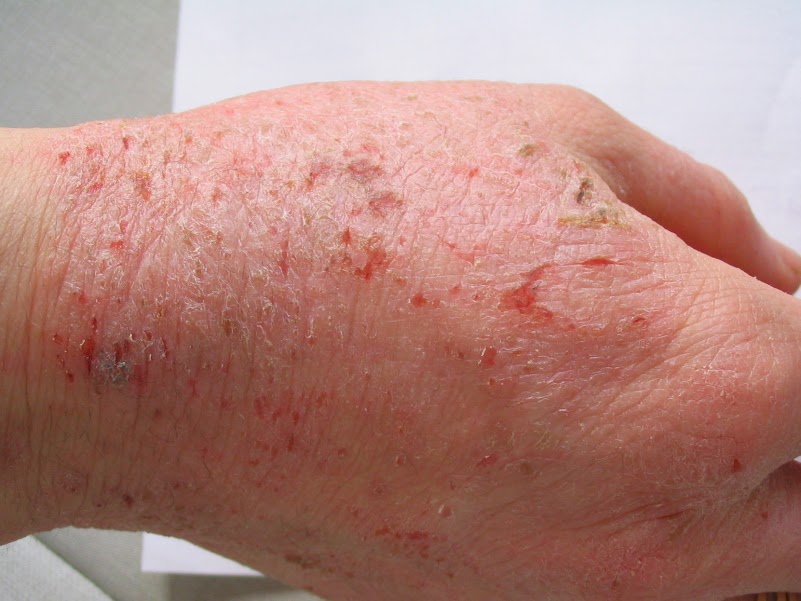 Dermatology Definition Health And Beauty