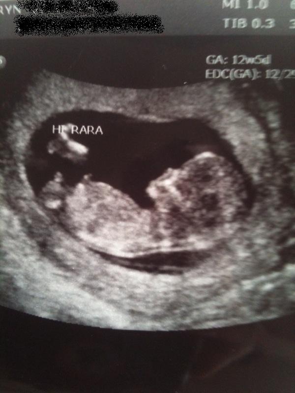 Pregnancy calendar and baby development, pregnancy baby kicking cervix