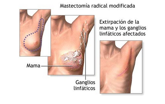 Por cuanto es posible aumentar el pecho por los ejercicios