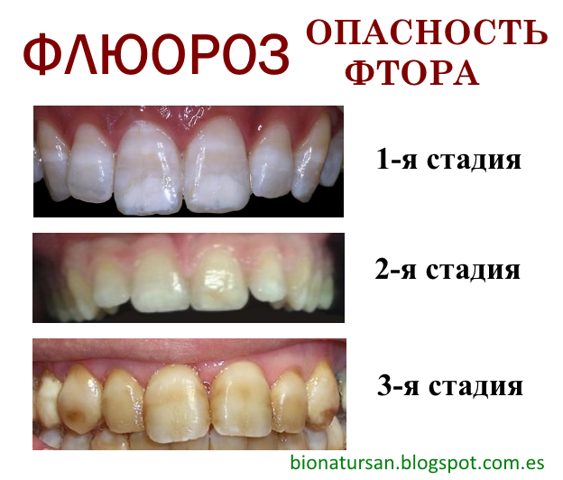 Гомеопатия ногти на ногах Гомеопатия ногти на ногах