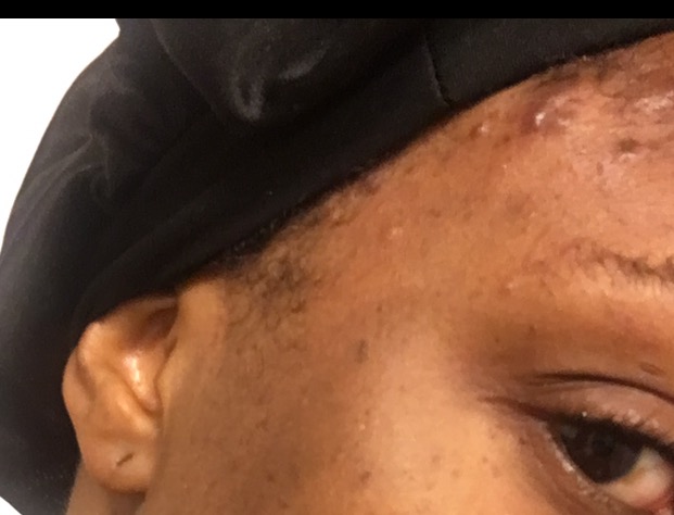 Synthetic Hair Almost Ruined My Skincare Blogger Life Skin First Daily