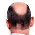 On recognize Bald Head