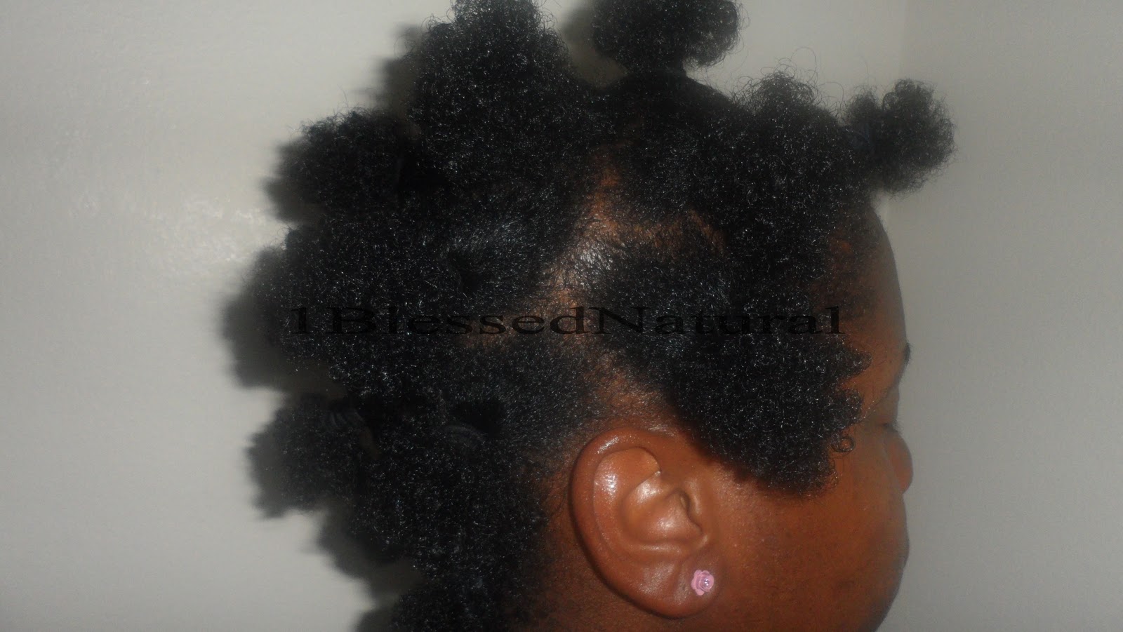 After Banding The Pineapple Method Revisited