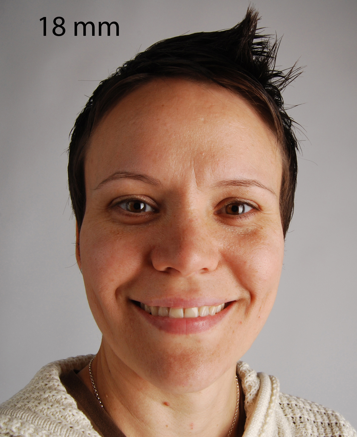 digital dental photo blog Macro Lens = Portrait Lens