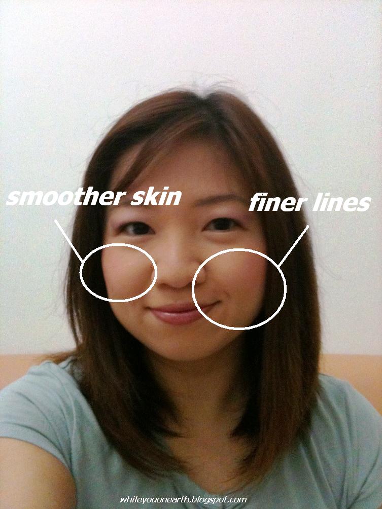 Pore Minimizing