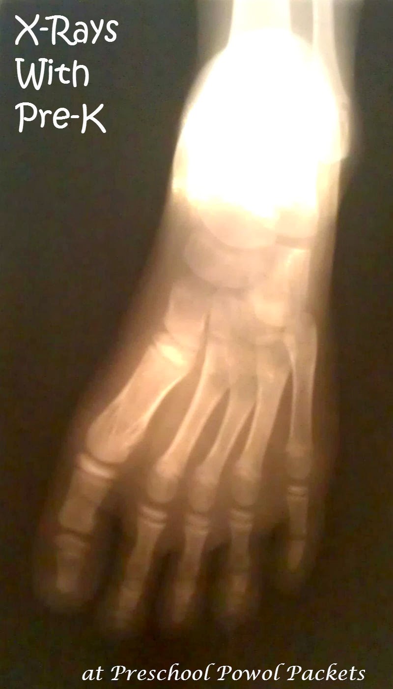 Real XRays With Preschoolers Science Experiment Preschool Powol Packets