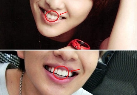 onew teeth