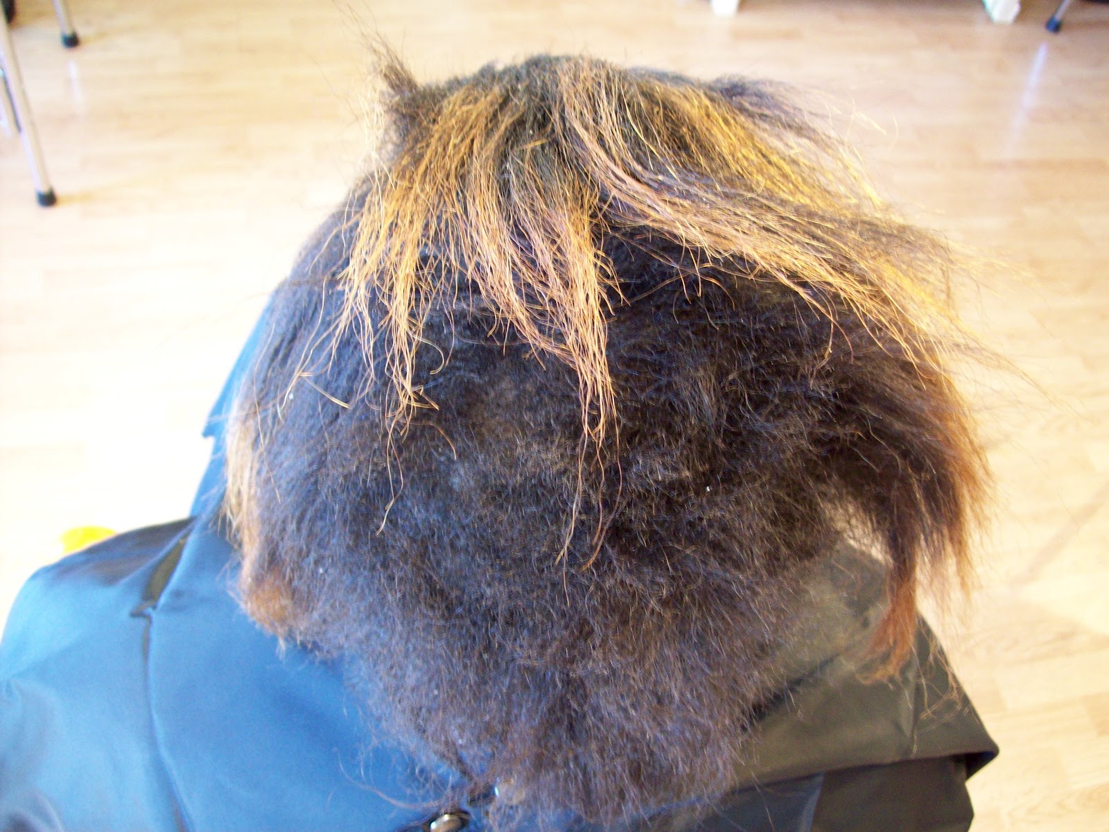 Severe Hair Breakage Severe Hair Breakage