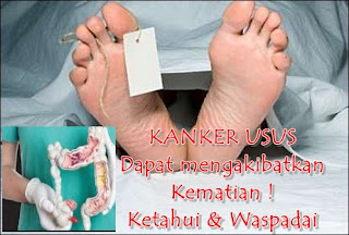 http://pantanganpenderitakankerusus.blogspot.com/