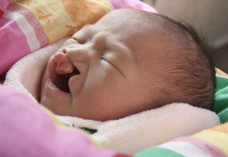 Treatment For Cleft Lip And Cleft Palate October 2011