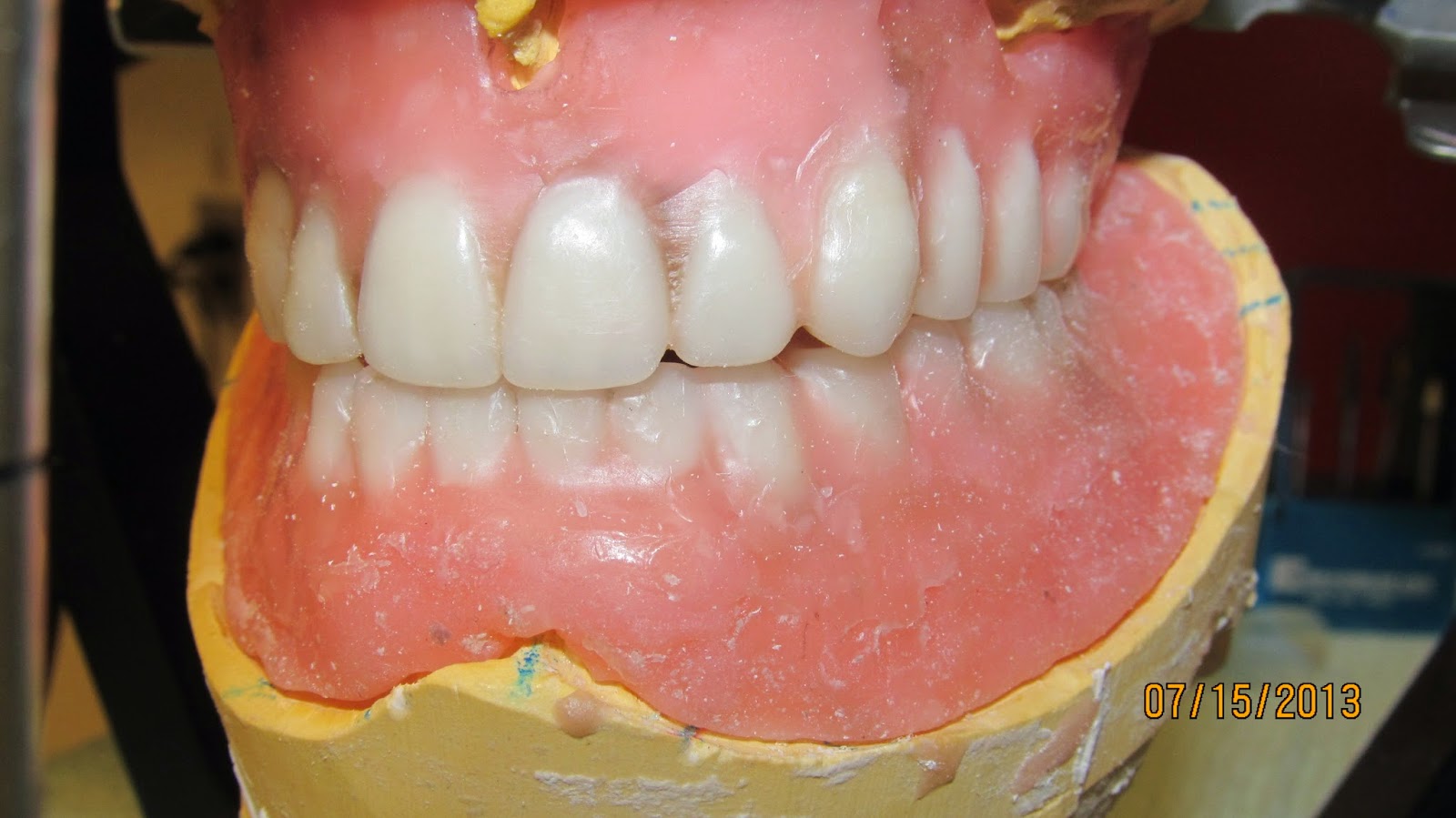 Dental Clinical Case Presentations StepbyStep guides Complete