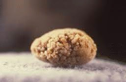 Prirodni Lijekovi Ljekovito Bilje Lijek Za Topljenje Kamenca U Bubregu I Zuci