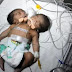 بالصور: ولادة طفل برأسين في الهند !