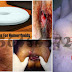 Obat Wasir Selain Superhoid Suppositoria thumbnail