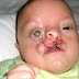 Ce bébé ne pèse que 700 grammes et il est défiguré, voici ce qu'il est devenu 9 ans plus tard!