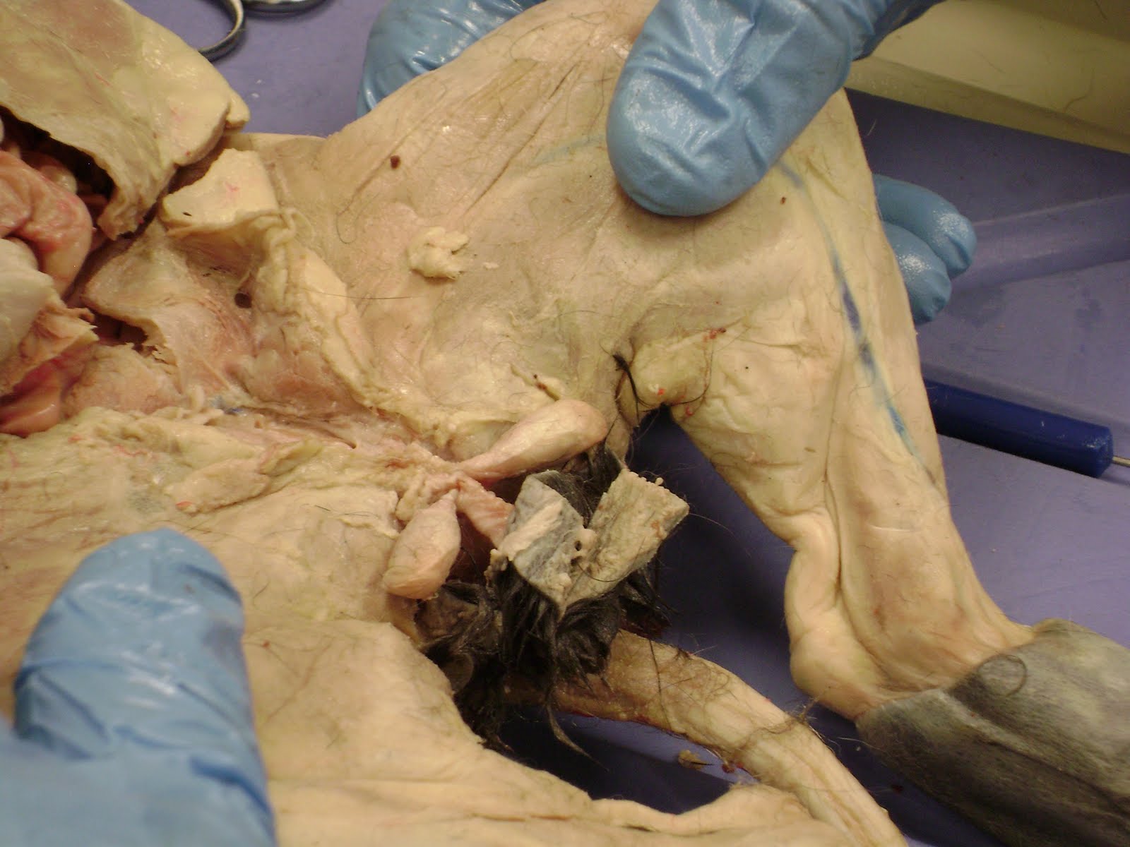 Anatomy and Physiology 2 Eportfolio: The Endocrine System & It's Hormones