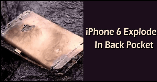 iPhone 6 Explodes In Back Pocket, Man Suffers Severe Burns