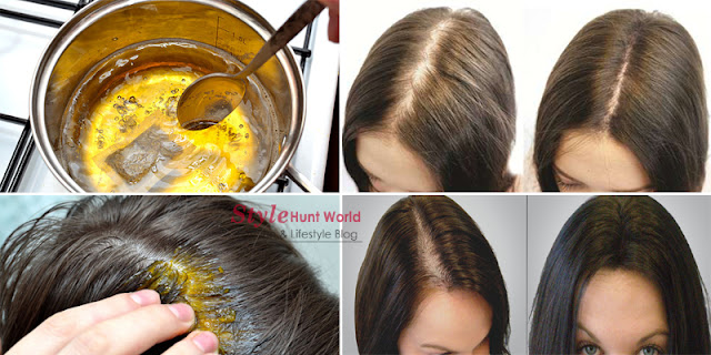 Hair Loss Treatment How To Stop Hair Loss With Natural