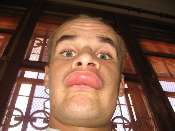 Lip Boil
