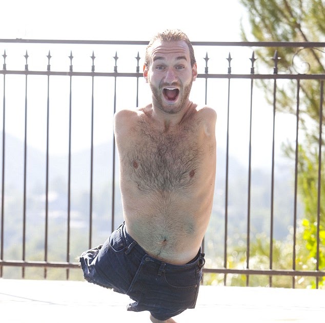 No Arms, No Legs, No Worries God Gives Us Strength