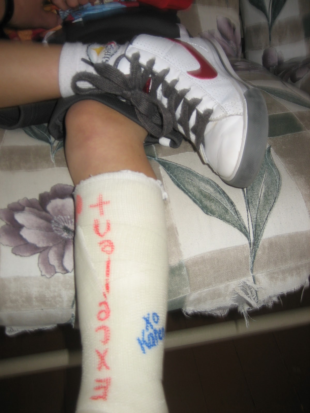 Kevin's Healing Journey Left Foot Cast 1