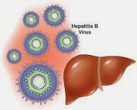 informasi tentang penyakit hepatitis