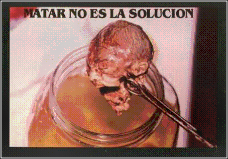 IMAGEN SOBRE ABORTO imagen sobre aborto: