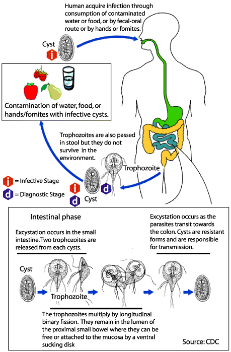giardiasis