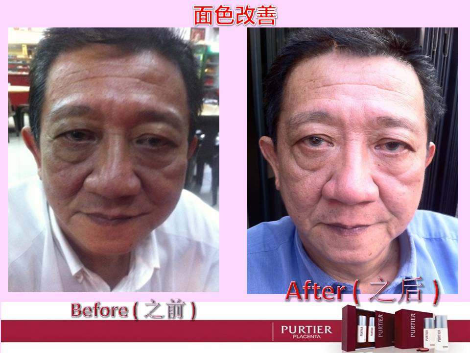 REVERSE AGING