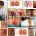 Harga Obat Ambeien AmbeJOSS Di Apotik Herbal thumbnail