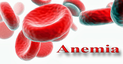 Anemia semasa hamil