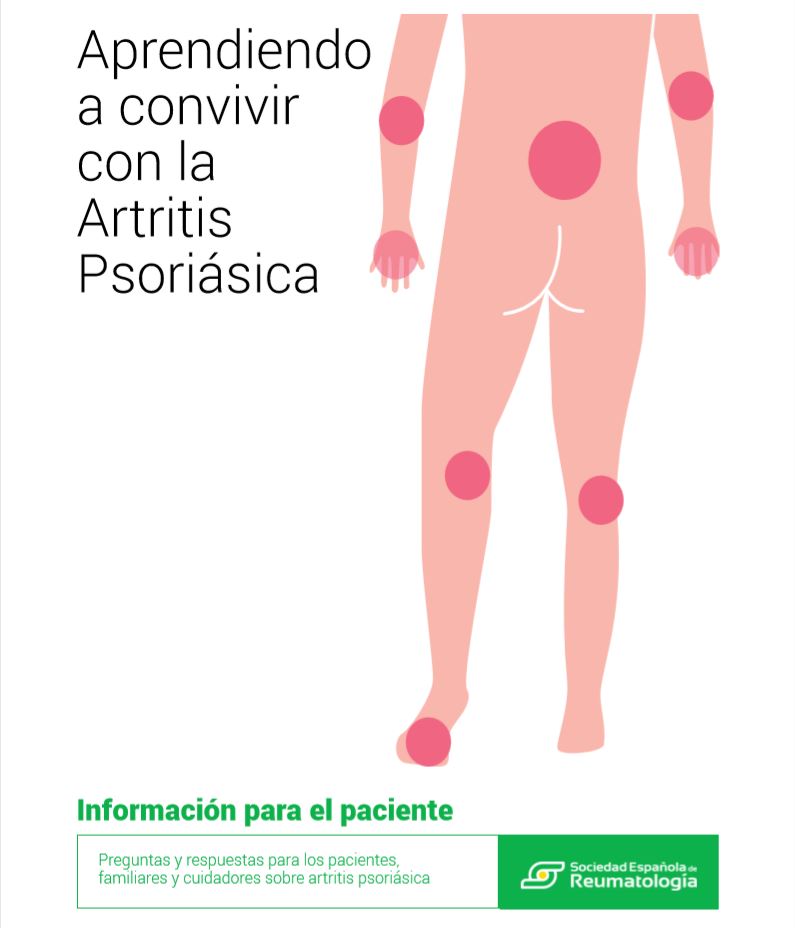 GUÍA DE LA ARTRITIS PSORIÁSICA