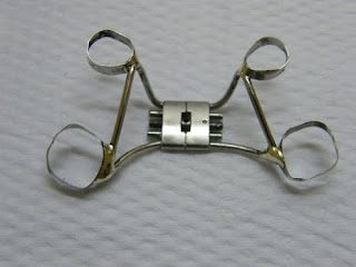 aparelho dentário, aparelho fixo, aparelho ortodontico, diário aparelho dentário, expansor fixo, hirax, hyrax, mordida cruzada, ortodontia, aparelho dentário, aparelho fixo, aparelho ortodontico, diário aparelho dentário, expansor fixo, hirax, hyrax, mordida cruzada, ortodontia,