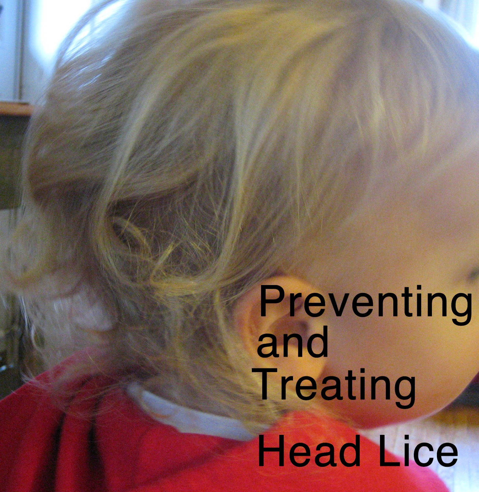 Preventing and Treating Head Lice My Scraps