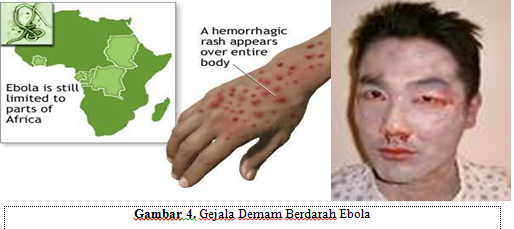 Artikel Virus Ebola Makalah Terbaru