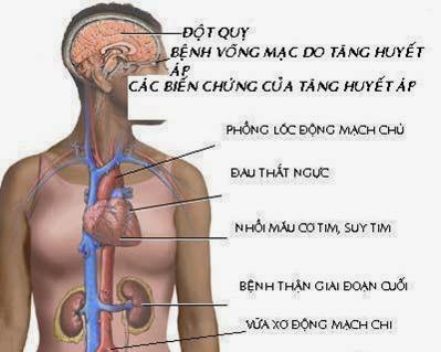 TĂNG HUYẾT ÁP CÓ THỂ GÂY SUY THẬN TĂNG HUYẾT ÁP CÓ THỂ GÂY SUY THẬN