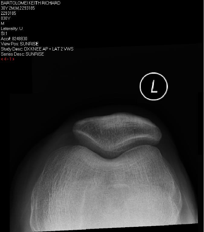 Road to Boston Orthopedic Consult